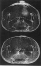 Mouse Brain on CRF