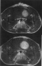 Mouse Brain On Placebo