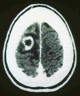 MRI image